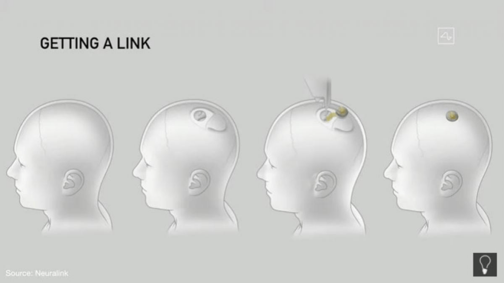 Neurolink, Elon Musk, Wikipedia,